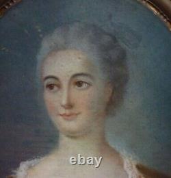 Portrait Femme Ovale Epoque Louis XV Pastel Du XIXème Siècle